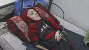 25.000 Anak di Gaza Yatim Piatu, 1 dari 6 Anak Kekurangan Gizi Akut Akibat Perang