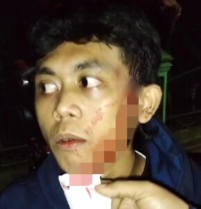 Nongkrong di Kawasan Rampal Malang, Pemuda Ini Jadi Korban Penganiayaan