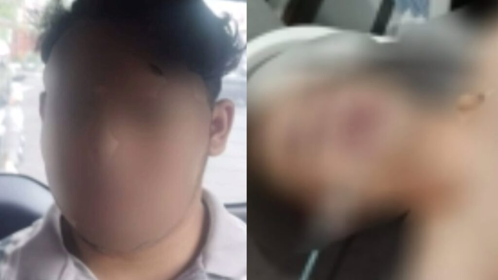 Emosi Gegara Terlalu Lama Nunggu Teman Wanita, Pemuda Asal Pagak Tusuk Temannya Pakai Besi