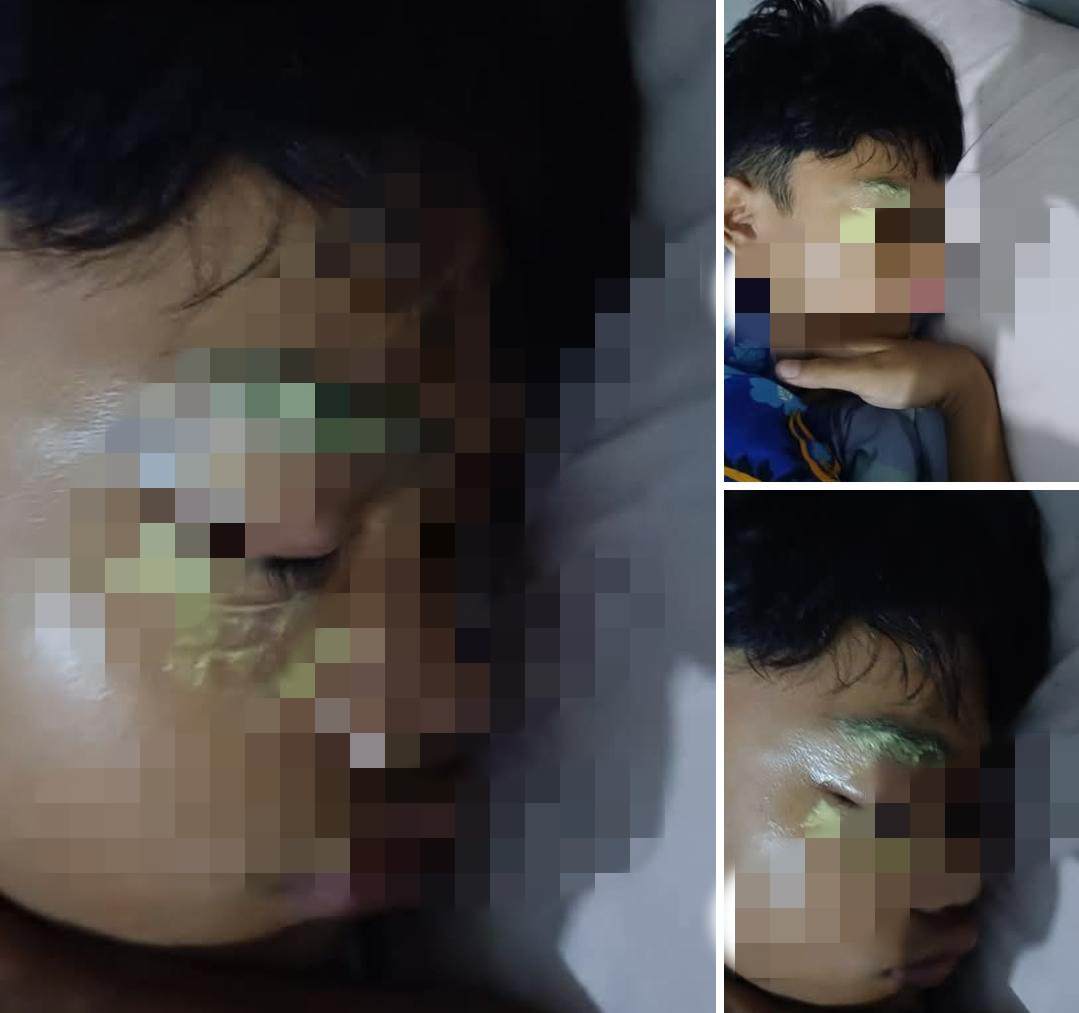 Insiden memilukan menimpa seorang pelajar SMP yang sedang bermain air di Sungai Metro kawasan Bandulan, Kota Malang, Kamis (29/5/2025) pagi. Korban, seorang siswa berinisial EL, mengalami luka serius pada bagian mata setelah diduga terkena lemparan batu oleh tiga anak lain yang masih sebaya.