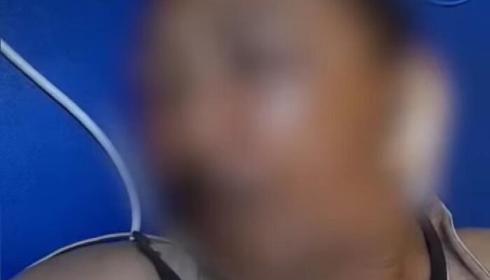 Penganiayaan di Jabung Malang Viral: Pelaku Bersenjata Balok Kayu, Korban Masuk IGD