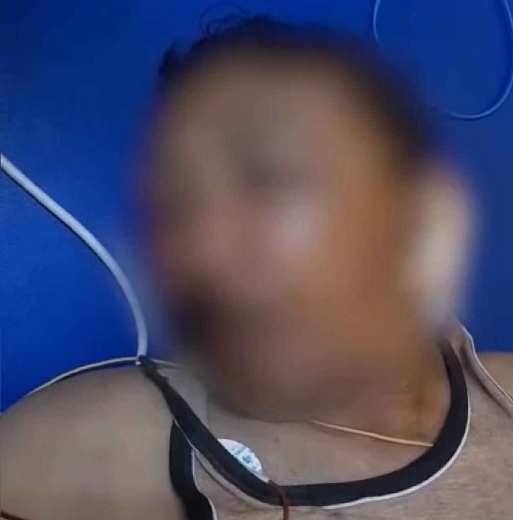 Penganiayaan di Jabung Malang Viral: Pelaku Bersenjata Balok Kayu, Korban Masuk IGD