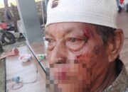 Pria di Sampang Dianiaya Tetangga, Dipicu Tuduhan Ilmu Hitam