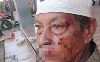 Pria di Sampang Dianiaya Tetangga, Dipicu Tuduhan Ilmu Hitam