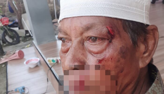 Pria di Sampang Dianiaya Tetangga, Dipicu Tuduhan Ilmu Hitam