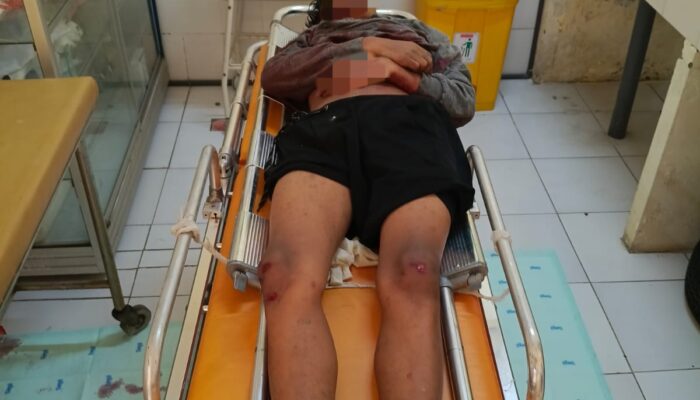 Diduga Laka Tunggal, Pria Misterius Ditemukan Tewas Tanpa Identitas